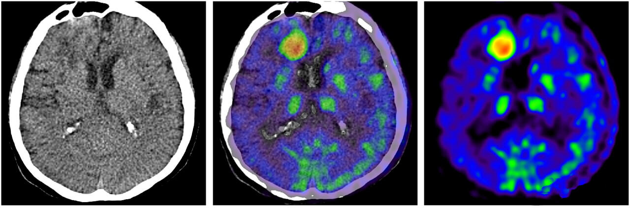 Mobile PETCT Scanner Rental Background.jpg